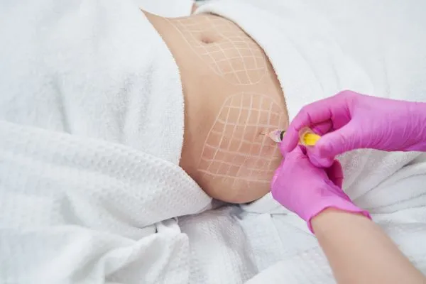image of fat dissolving injections on love handles to help combat weight gain Runnymede