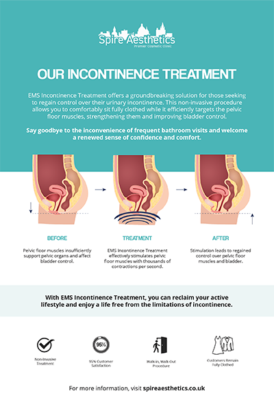 image to show how EMS treatment works for female urinary incontinence Runnymede