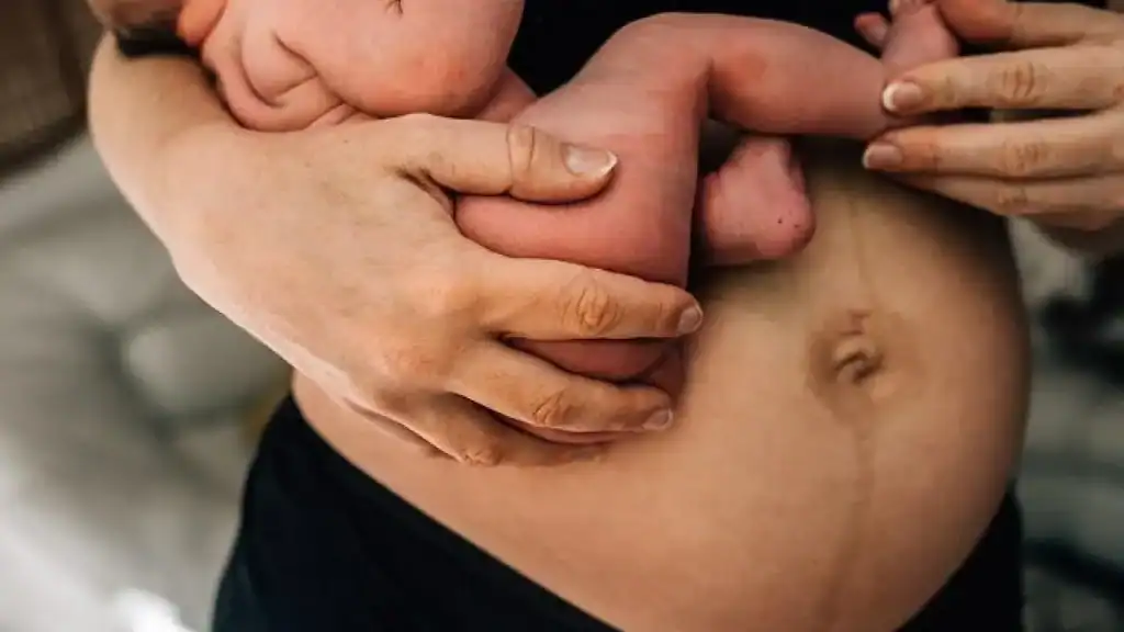 Why Is My Stomach Still Big After Pregnancy Runnymede?
